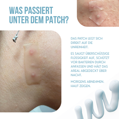 Azaléa Anti-Pickel Patch Rolle™