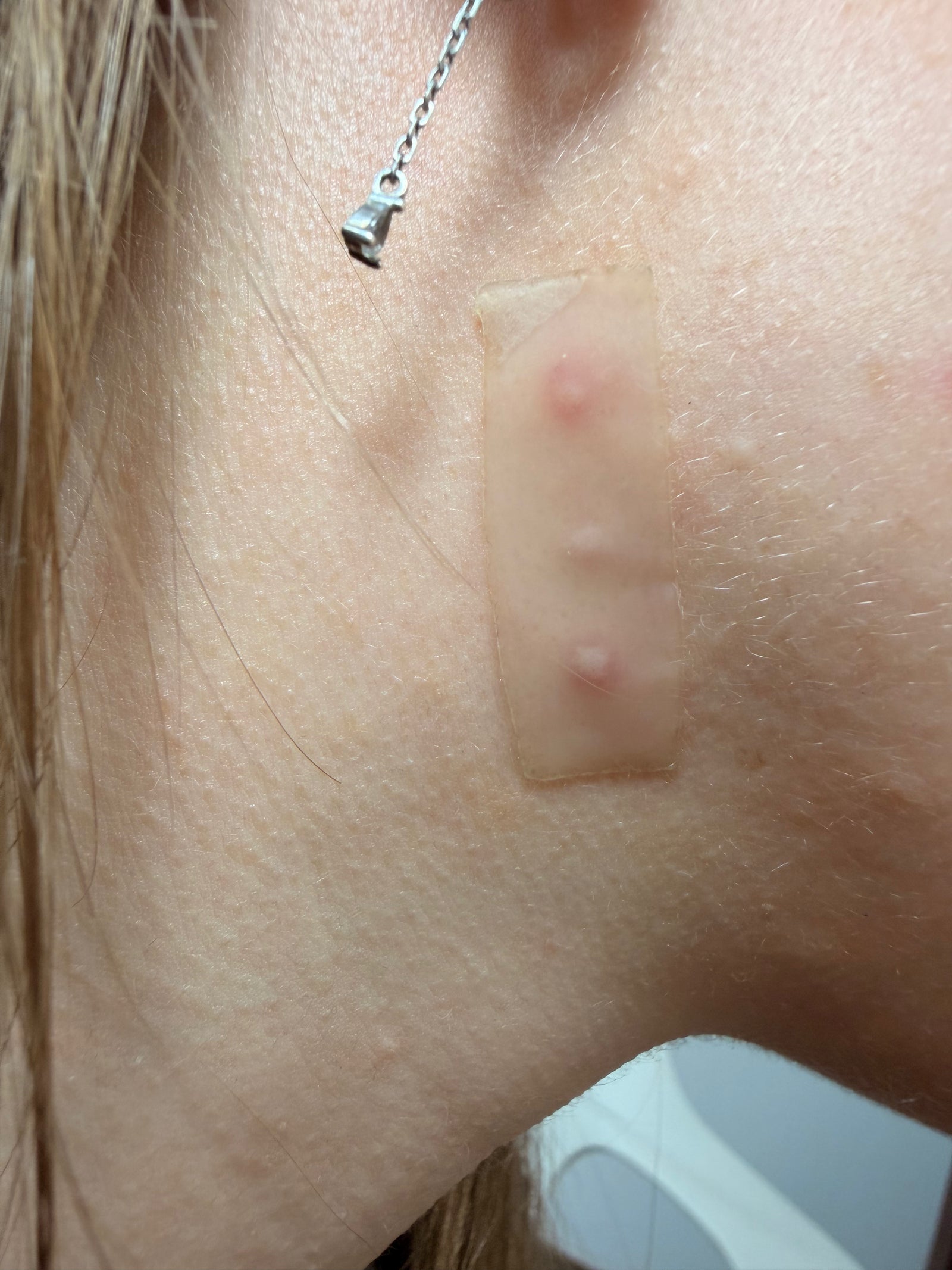 Was unter dem Patch